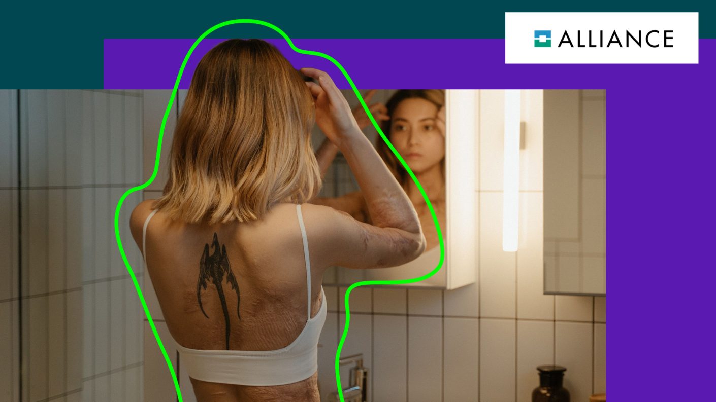 Woman with scars and a tattoo on her back looking in the mirror